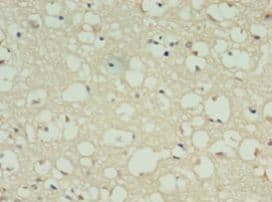 DRD5 / Dopamine Receptor D5 Antibody (aa361-477)