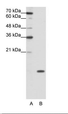 SNRPD1 / SMD1 Antibody (aa21-70)