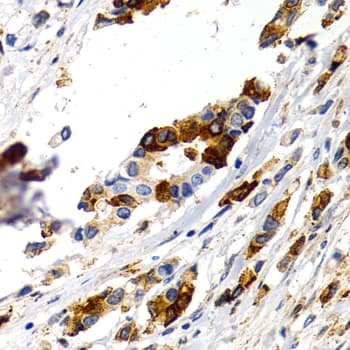 TFF1 / pS2 Antibody