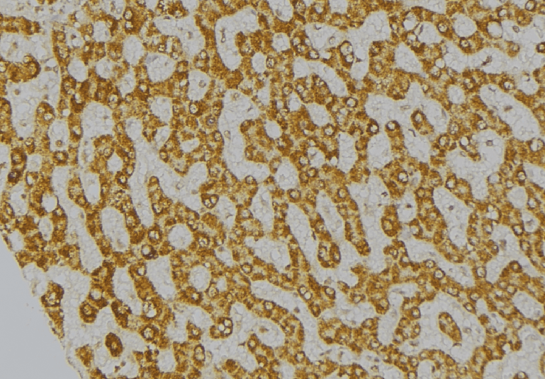 Polyclonal Rabbit anti-Human BCAR1 / p130Cas Antibody (IHC, IF, WB)