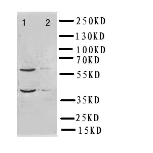 Polyclonal Rabbit anti-Human IRF2 Antibody (aa249-266, WB)