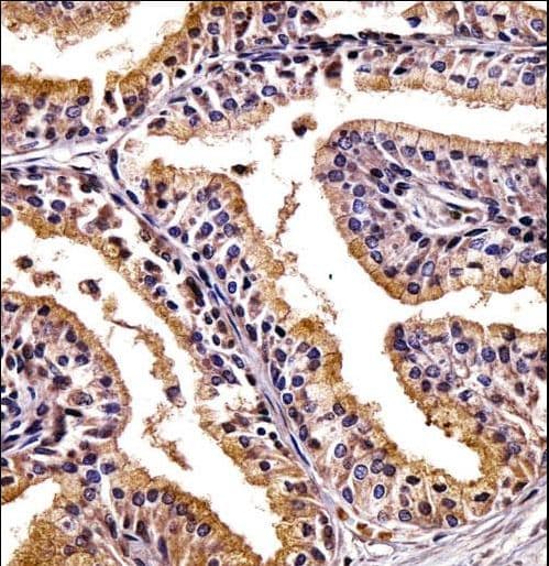 PHLDA2 / TSSC3 Antibody (aa90-119)