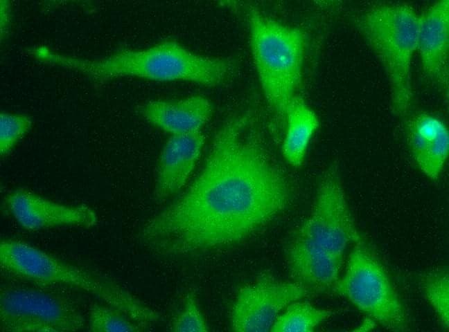 IHC-plus™ SQSTM1 Antibody