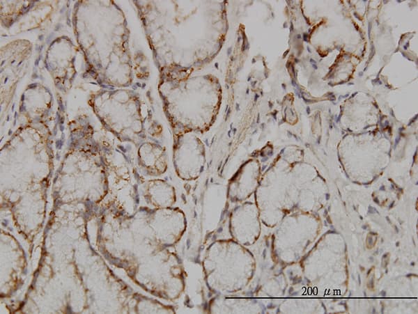 Monoclonal Mouse anti-Human SOCS5 Antibody (clone 2D1, IHC, WB)