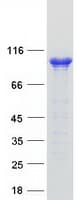 Human AP2B1 Protein (Recombinant Myc-DDK (Flag))