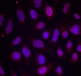 MEF2A / MEF2 Antibody