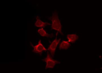 CSNK1G1 / CKI-Gamma 1 Antibody