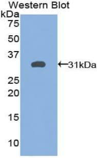 TG / Thyroglobulin Antibody (aa2418-2660)