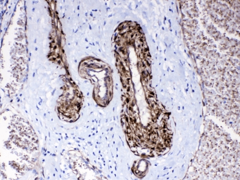 Polyclonal Rabbit anti-Human PPP1R14A / CPI-17 Antibody (IHC, WB)