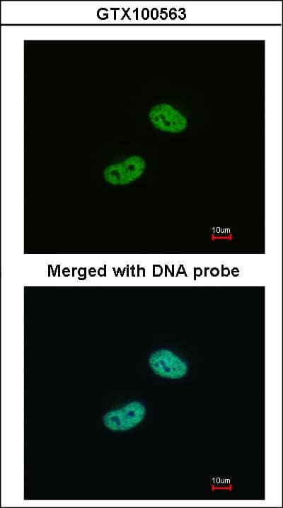 WT1 / Wilms Tumor 1 Antibody