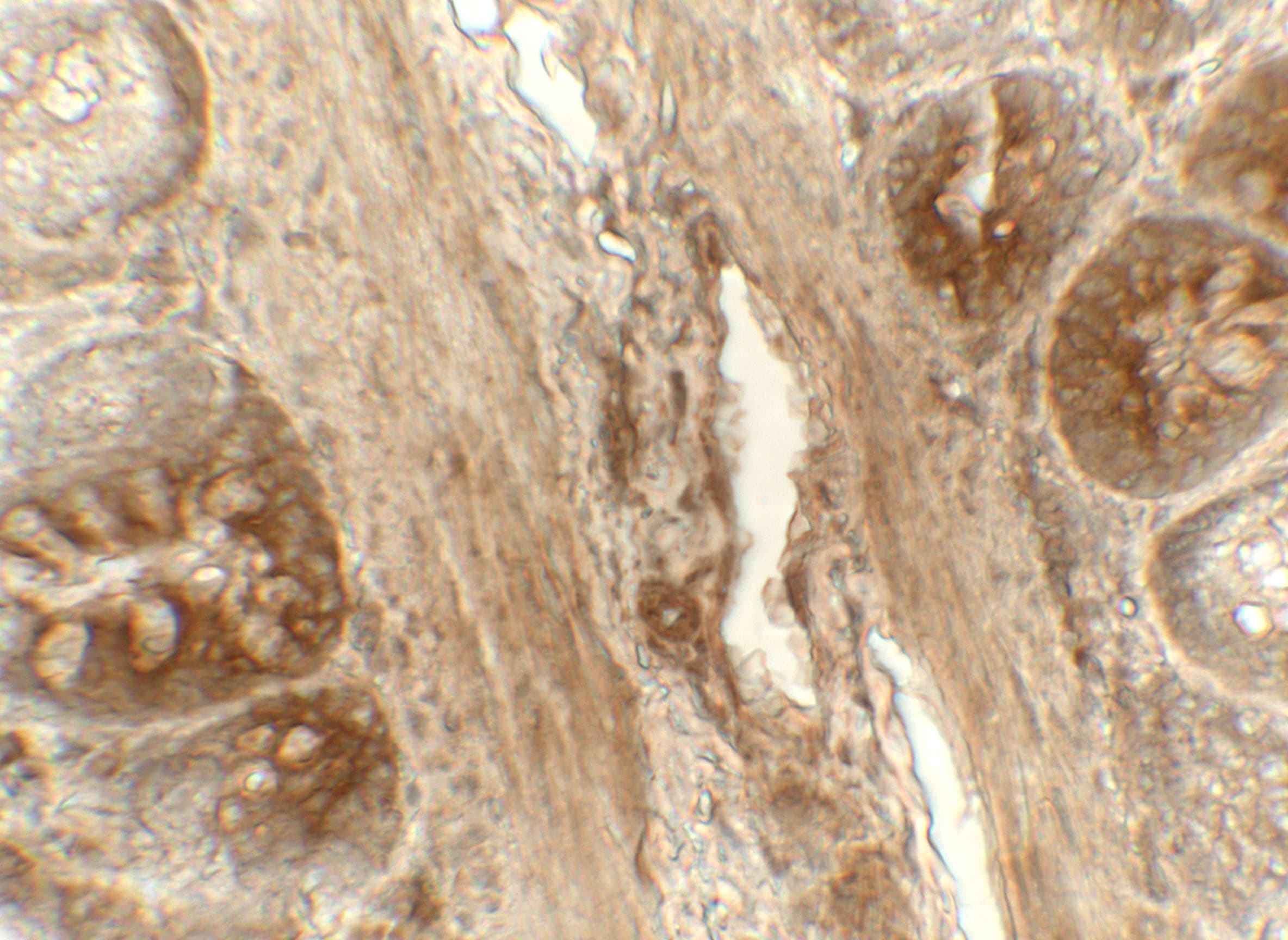 PDIA4 / ERP72 Antibody