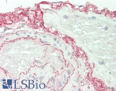 IHC-plus™ Polyclonal Rabbit anti-Human ELN / Elastin Antibody (IHC, WB)