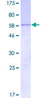 Human CISH / SOCS Protein (Recombinant GST)