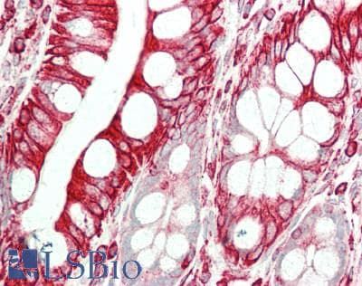 IHC-plus™ CHRM4 / M4 Antibody (210-290 aa, Internal)