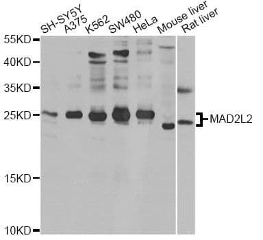 Polyclonal Rabbit anti-Human MAD2B / REV7 Antibody (WB)