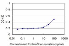 IHC-plus™ DLD / Diaphorase / E3 Antibody (clone 1G11)