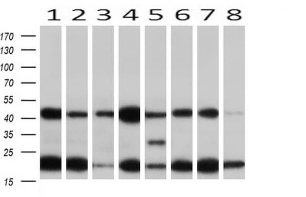 MAP2K1 / MKK1 / MEK1 Antibody (clone OTI4E1)
