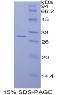 Rat CFD / Factor D / Adipsin Protein (Recombinant His, N-Terminal)