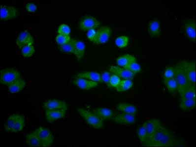 LPL / Lipoprotein Lipase Antibody