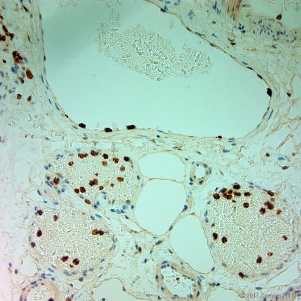 MPO / Myeloperoxidase Antibody
