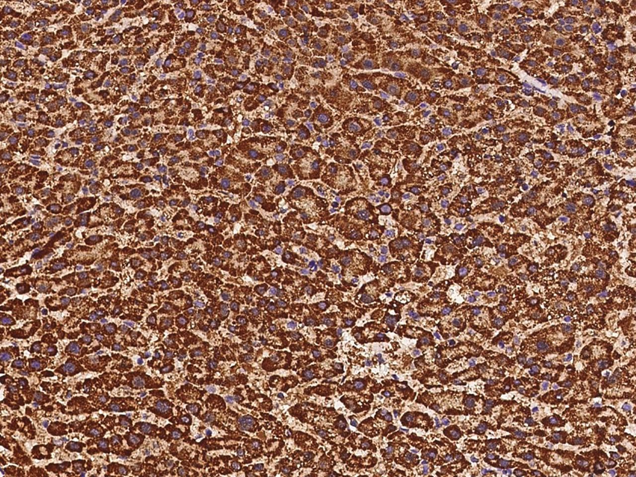 Polyclonal Rabbit anti-Human ETFB Antibody (IHC, IF, WB)