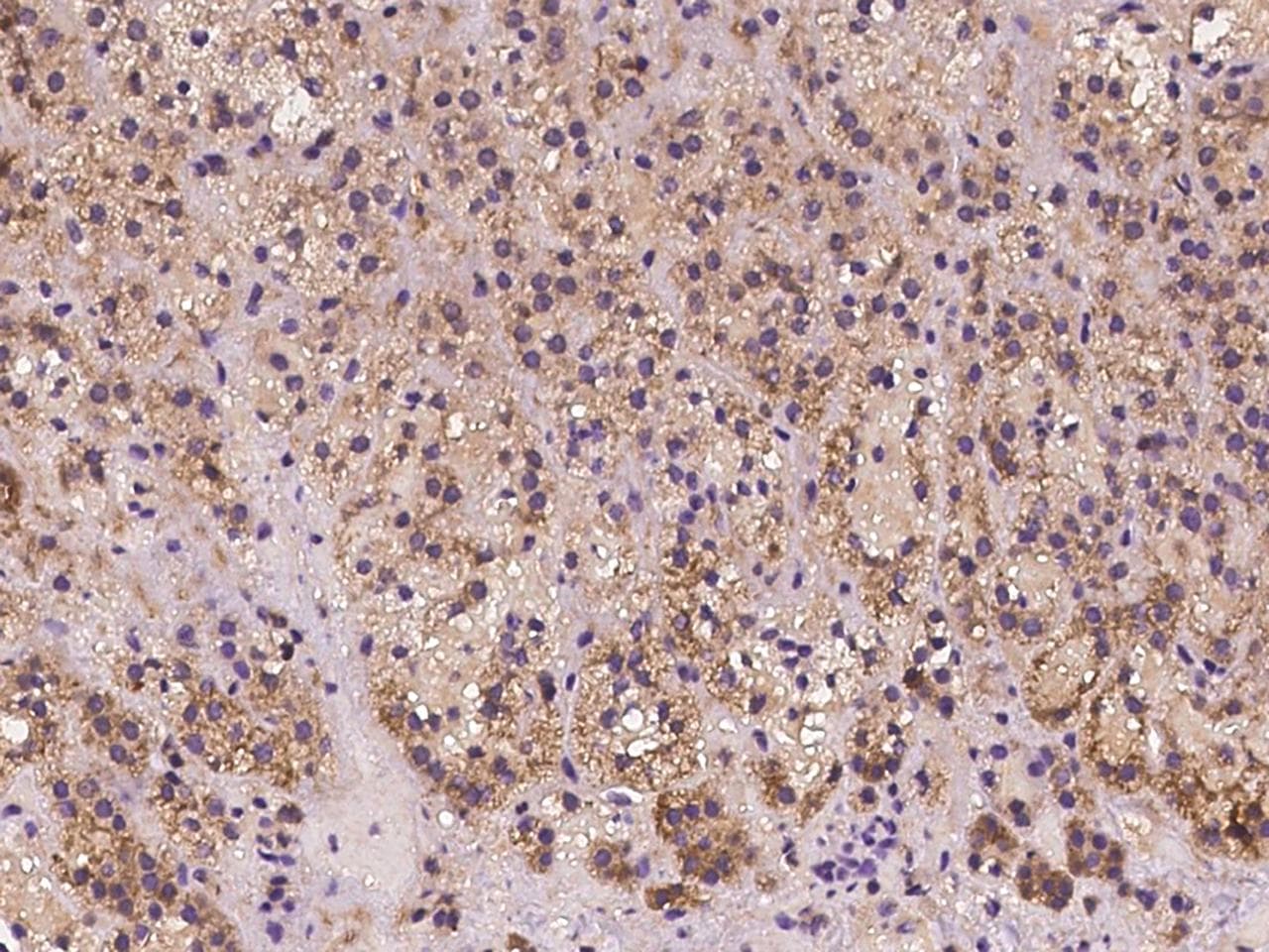 FGD6 Antibody