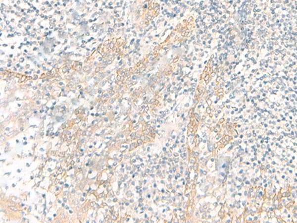 PSCA Antibody