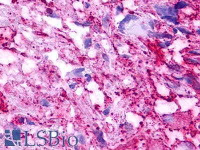 PathPlus™ GPR152 Antibody (Cytoplasmic Domain)
