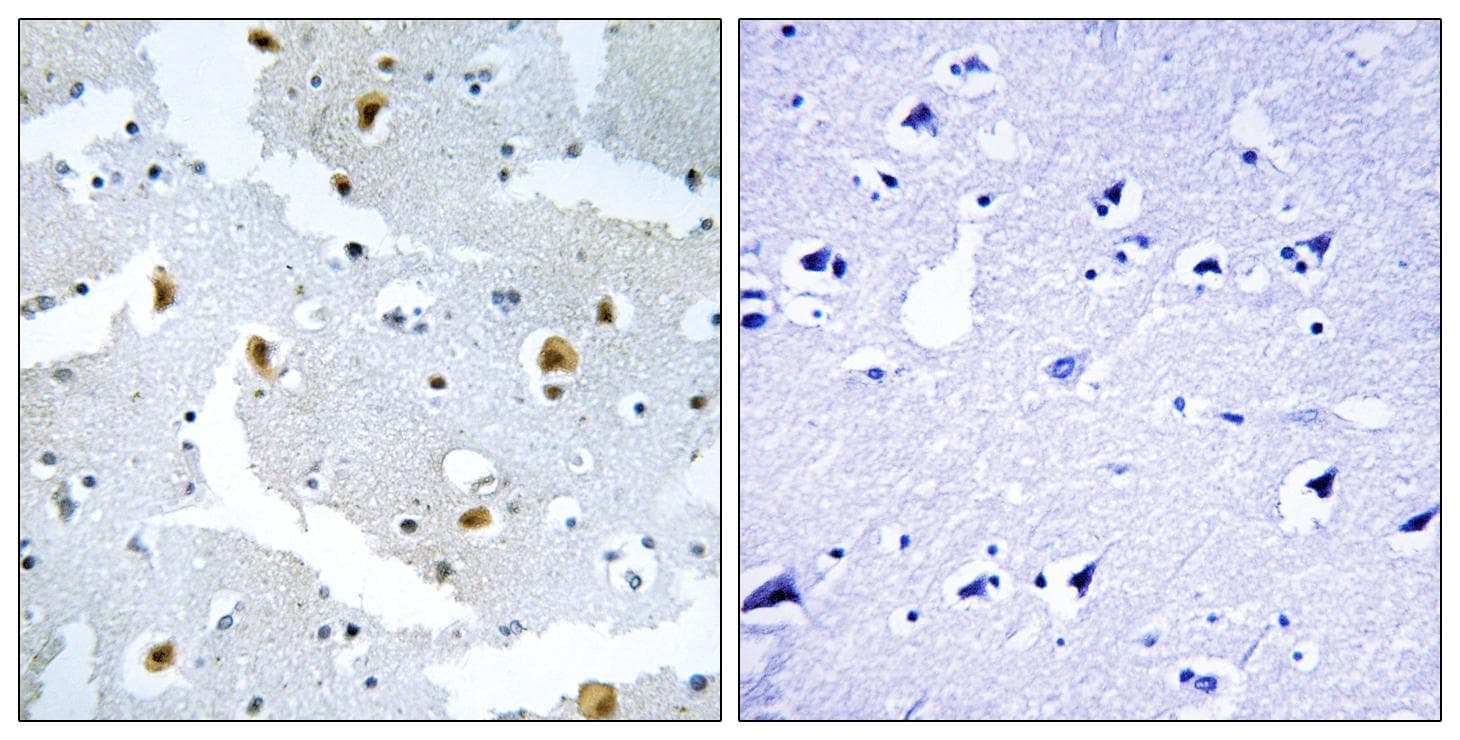 FMN2 / Formin 2 Antibody