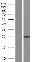 GS28 / GOSR1 / p28 Protein (Over-Expression Lysate Myc-DDK (Flag))