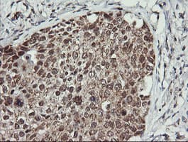 MAP2K2 / MKK2 / MEK2 Antibody (clone OTI1A2)