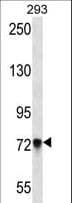 Polyclonal Rabbit anti-Human PCDHB5 Antibody (aa278-307, IHC, WB)