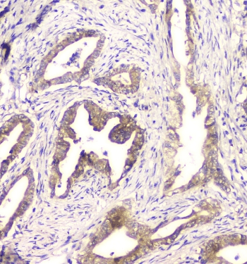 CHM / REP1 Antibody
