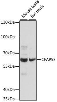 CFAP53 / CCDC11 Antibody