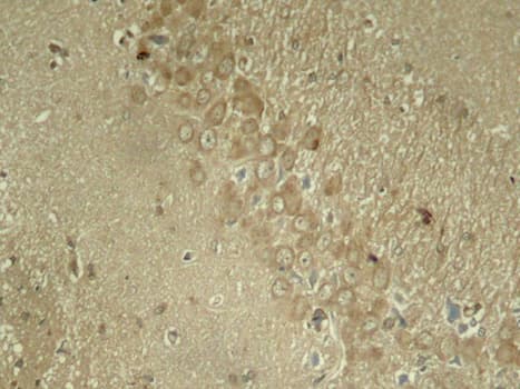 Polyclonal Rabbit anti-Human MAPT / Tau Antibody (phospho-Ser262, IHC, IF, WB)