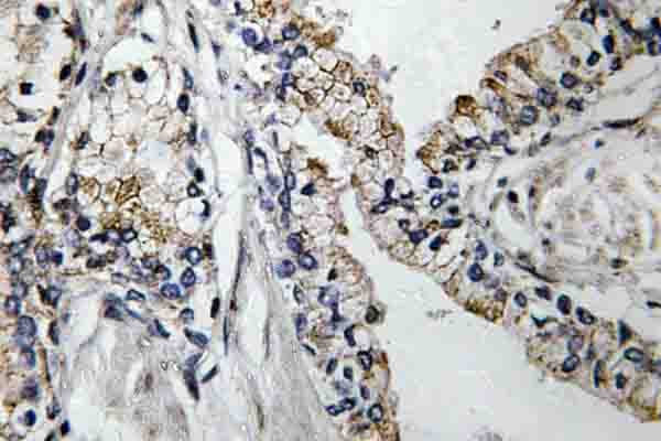 CLDN7 / Claudin 7 Antibody (Ser204)