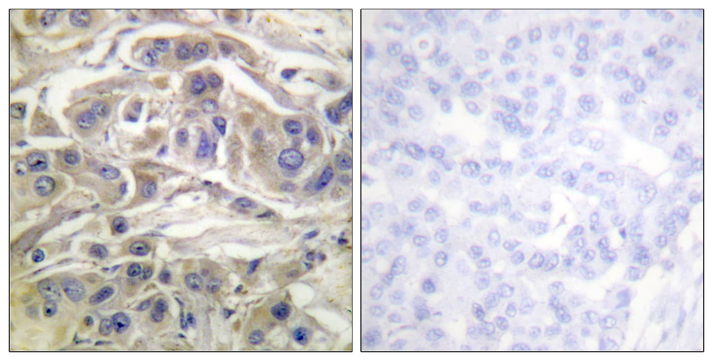 RAPGEF1 Antibody (aa470-519)