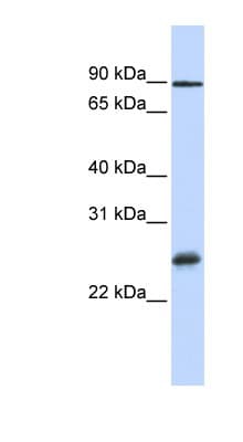 RBPMS / Hermes Antibody (C-Terminus, HRP)