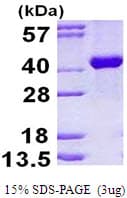 Human ALDOB Protein (Recombinant His)