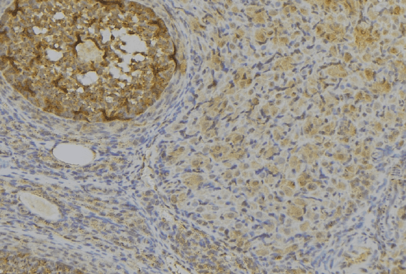 Polyclonal Rabbit anti-Human IGFBP1 Antibody (IHC, WB)