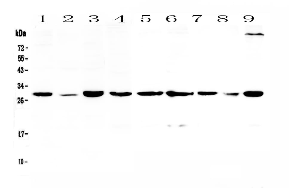 Polyclonal Rabbit anti-Human SFN / Stratifin / 14-3-3 Sigma Antibody (WB)