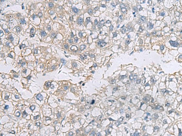 Polyclonal Rabbit anti-Human VEGFA / VEGF Antibody (IHC, WB)
