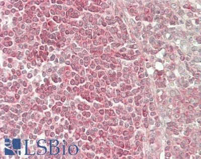 IHC-plus™ TFIP11 Antibody (aa1-50)