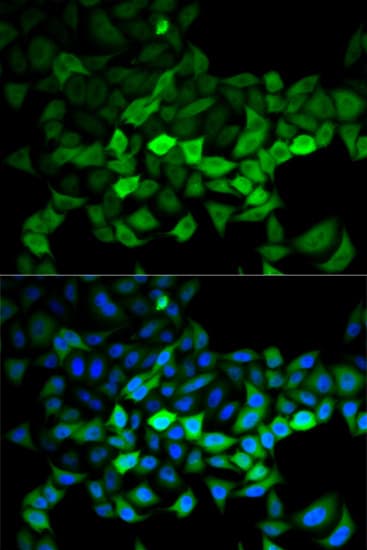 UBCH10 / UBE2C Antibody