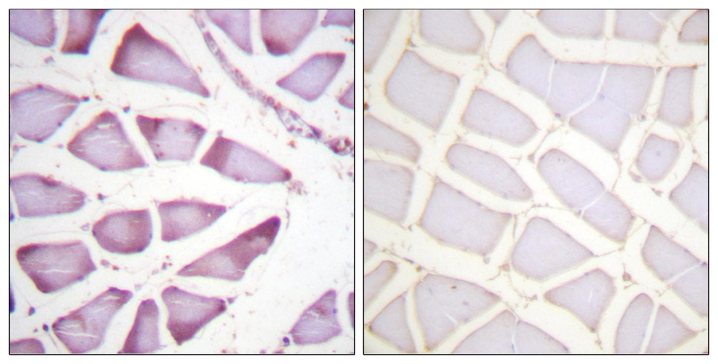 RPS6 / Ribosomal Protein S6 Antibody (p240)