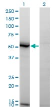 IHC-plus™ Monoclonal Mouse anti-Human ASAH1 / Acid Ceramidase Antibody (clone 1A7, IHC, WB)