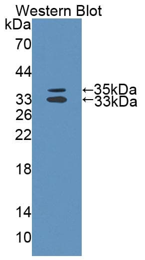 MTUS1 Antibody (aa1018-1270, PE)
