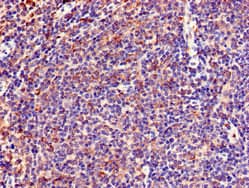 Polyclonal Rabbit anti-Human LNX1 / LNX Antibody (IHC)
