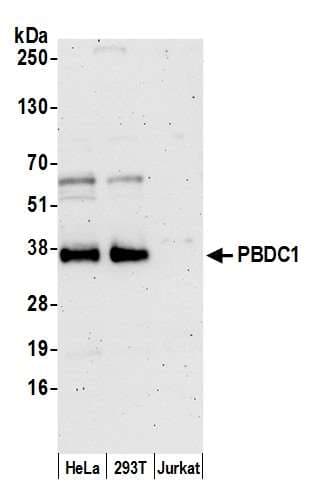 Polyclonal Rabbit anti-Human CXorf26 Antibody (aa1-50, WB)