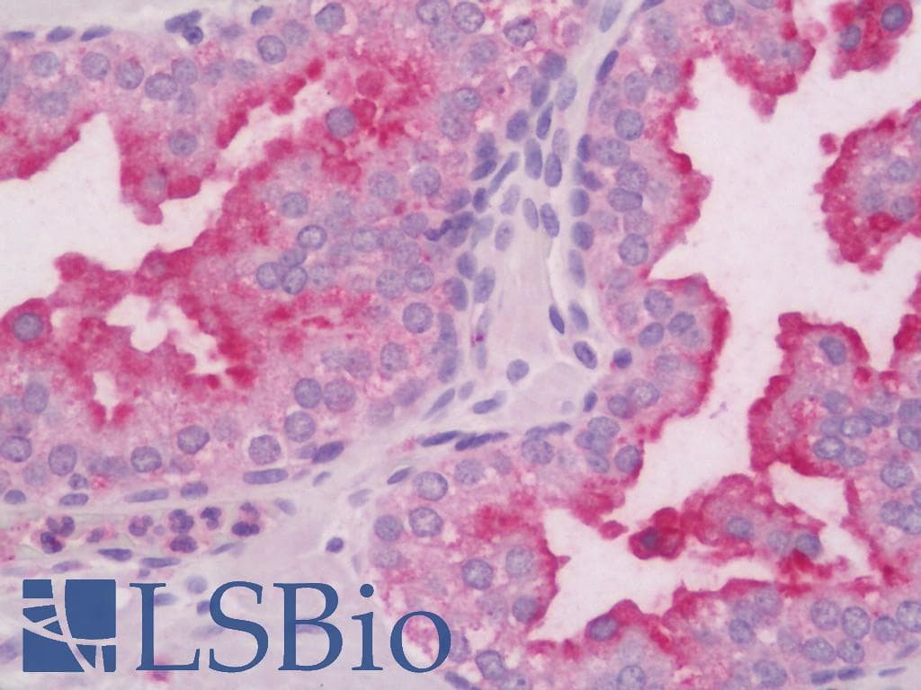 IHC-plus™ RAB27B Antibody (C-Terminus)